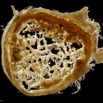 Querschnitt des Sehnervs einer Kuh. Dieses zusammengesetzte Bild wurde durch Focus Stacking aufgenommen. Querschnitt des Sehnervs einer Kuh. Dieses zusammengesetzte Bild wurde durch Focus Stacking aufgenommen.