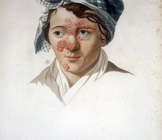 Portraits and Pathologies. Likenesses and Clinical Pictures in Early Nineteenth-Century France Portraits and Pathologies. Likenesses and Clinical Pictures in Early Nineteenth-Century France