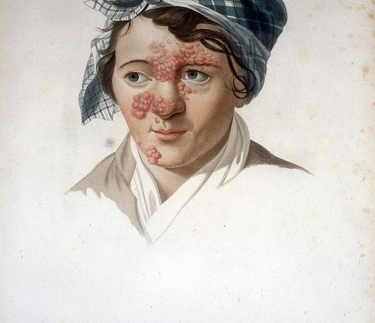 Portraits and Pathologies. Likenesses and Clinical Pictures in Early Nineteenth-Century France